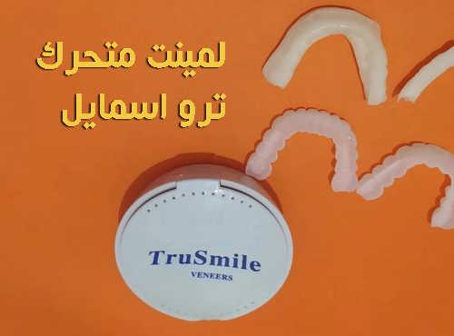 لمینت متحرک دندان snap on smile کجا بخریم+ نظرات و نحوه قالب گیری سریع 