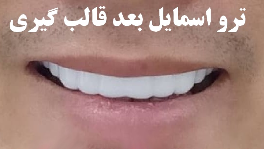 ترو اسمایل عکس