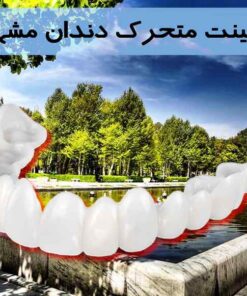 لمینت متحرک دندان مشهد