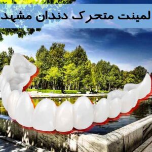 لمینت متحرک دندان مشهد